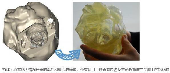Mimics | 医学影像处理软件